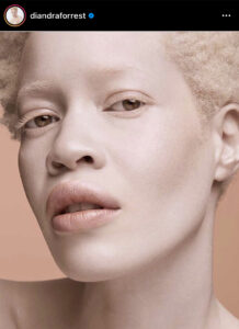 @diandraforrest une mannequin atteinte d'albinisme